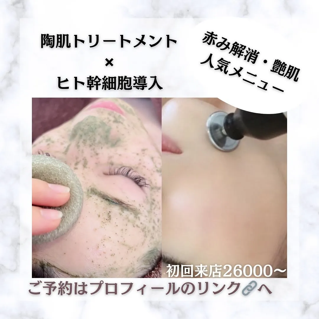 太田市にある頑固なニキビ専門店です✨️