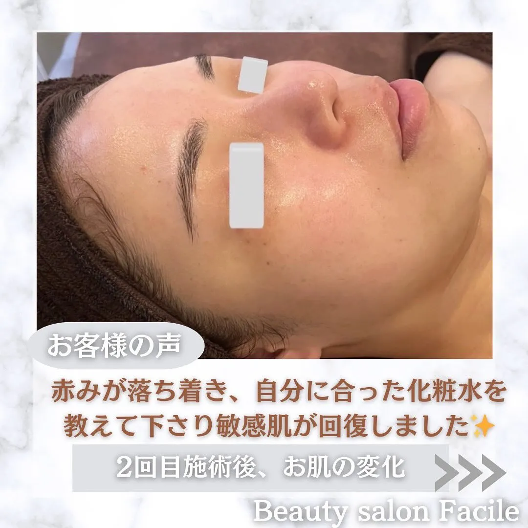 太田市にある頑固なニキビ専門店です✨️