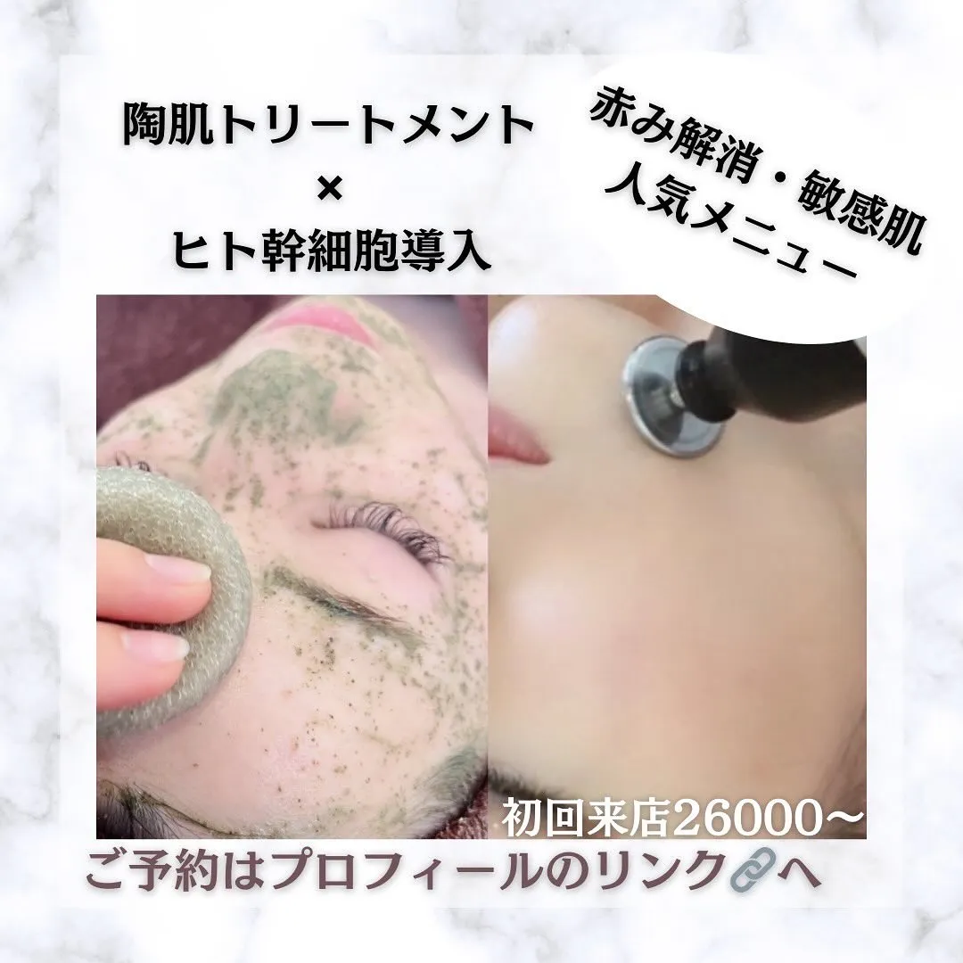 太田市にある頑固なニキビ専門店です✨️