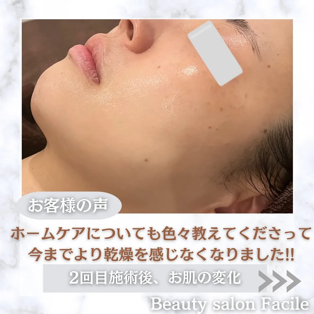 太田市にある頑固なニキビ専門店です✨️