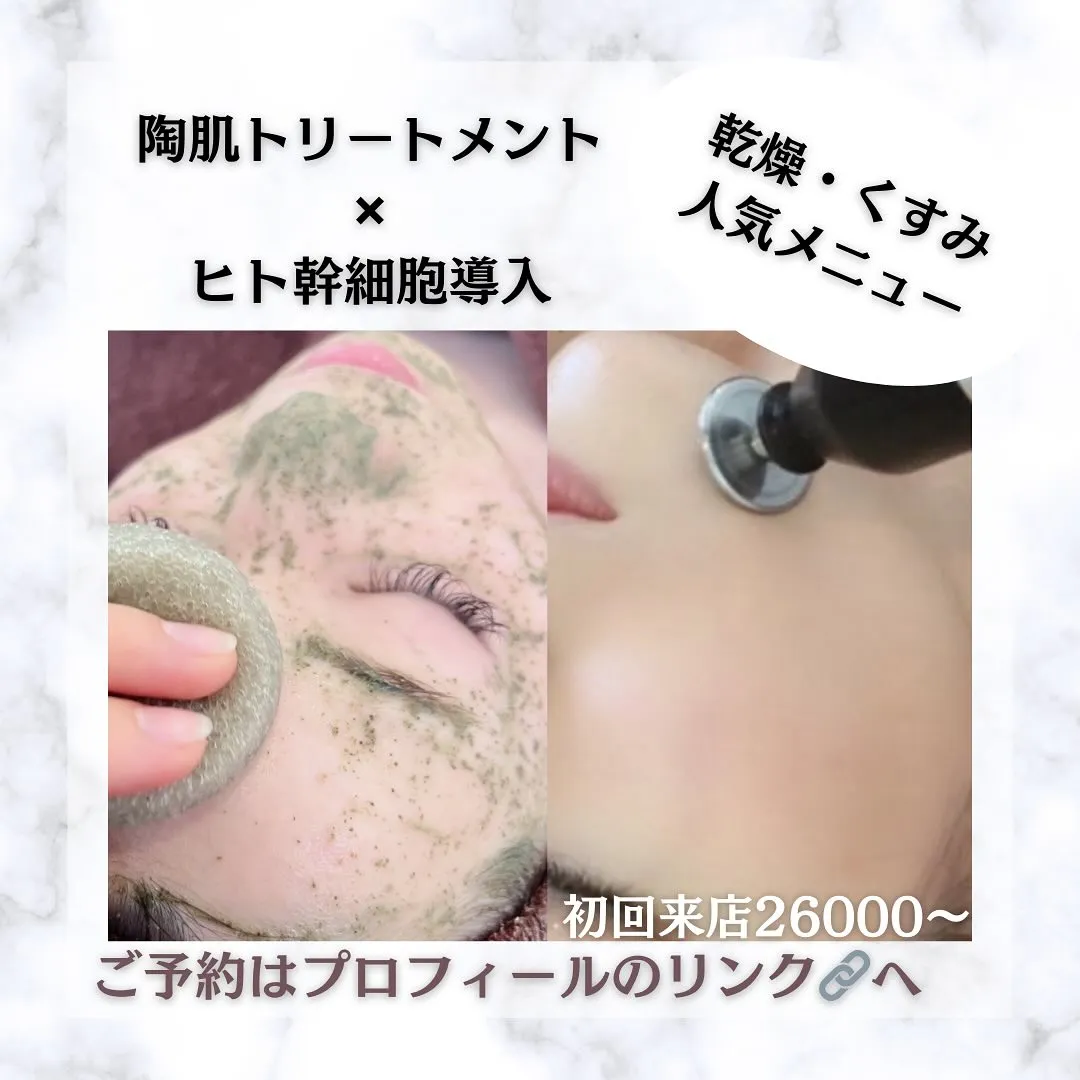 太田市にある頑固なニキビ専門店です✨️