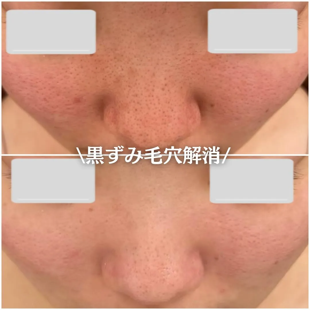 TOHKIPEEL【陶肌ピール】