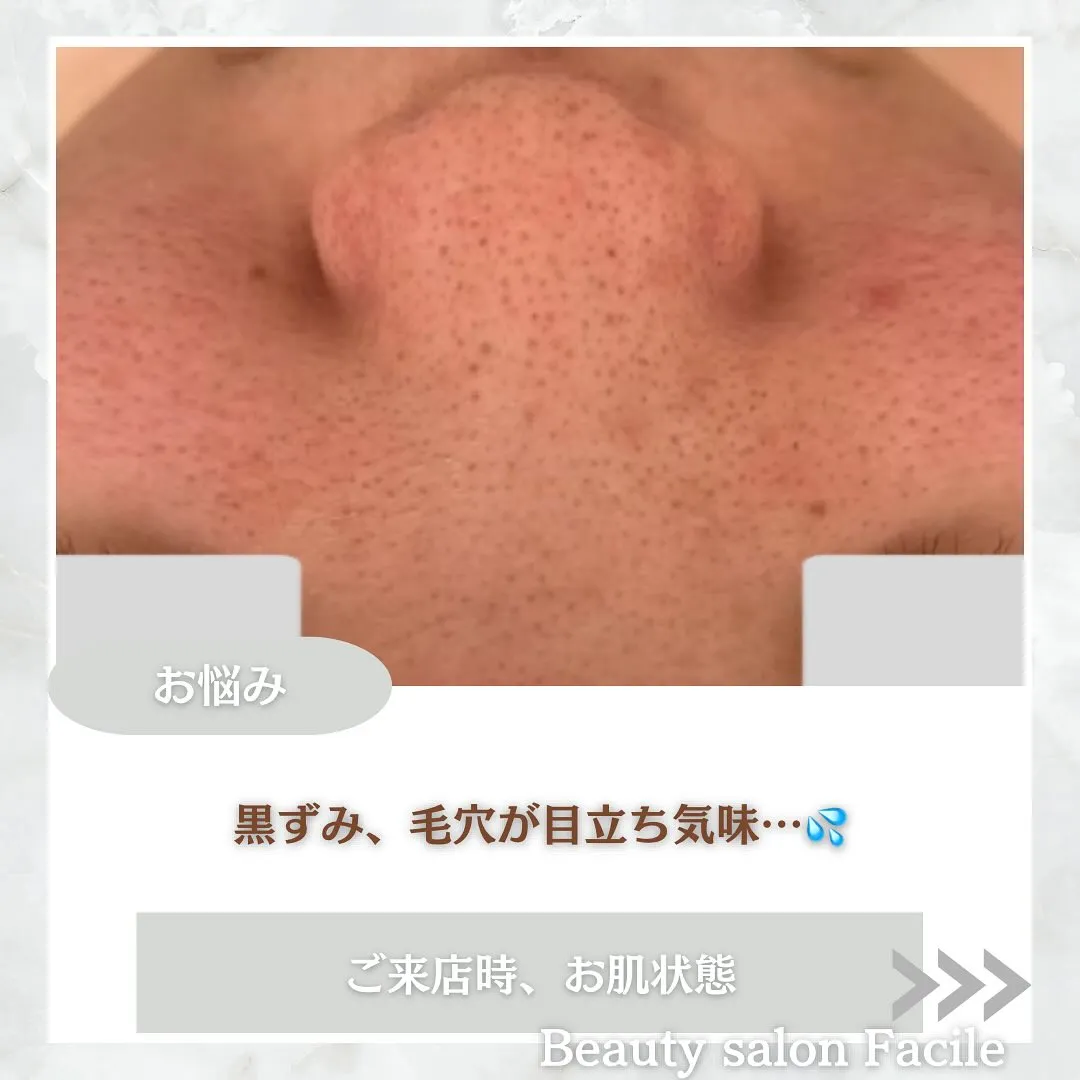 TOHKIPEEL【陶肌ピール】