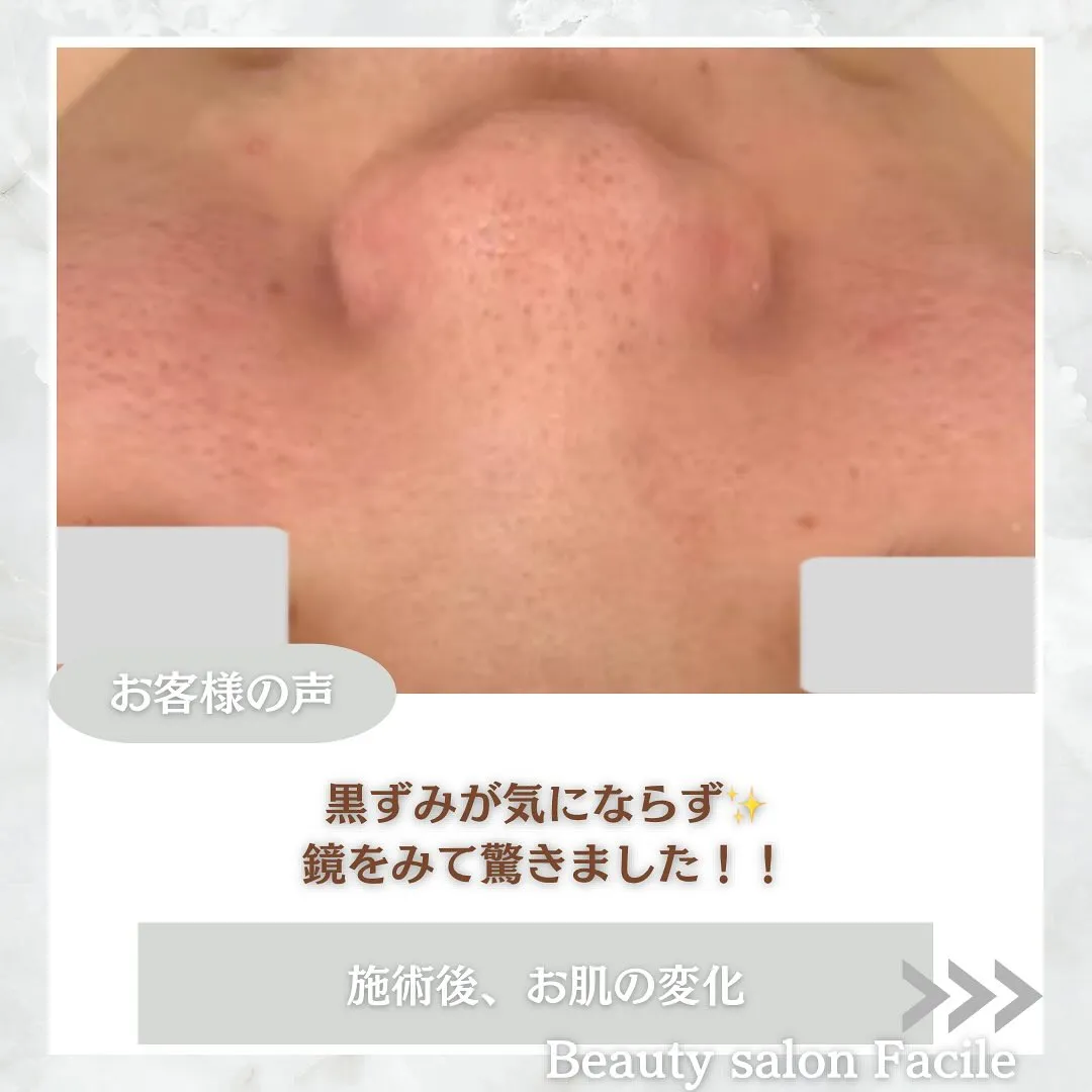 TOHKIPEEL【陶肌ピール】