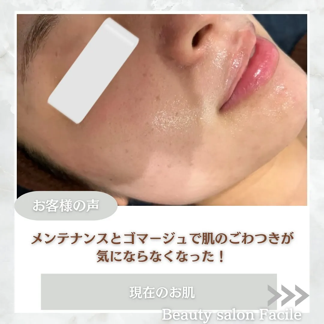 太田市にある頑固なニキビ専門店です✨️