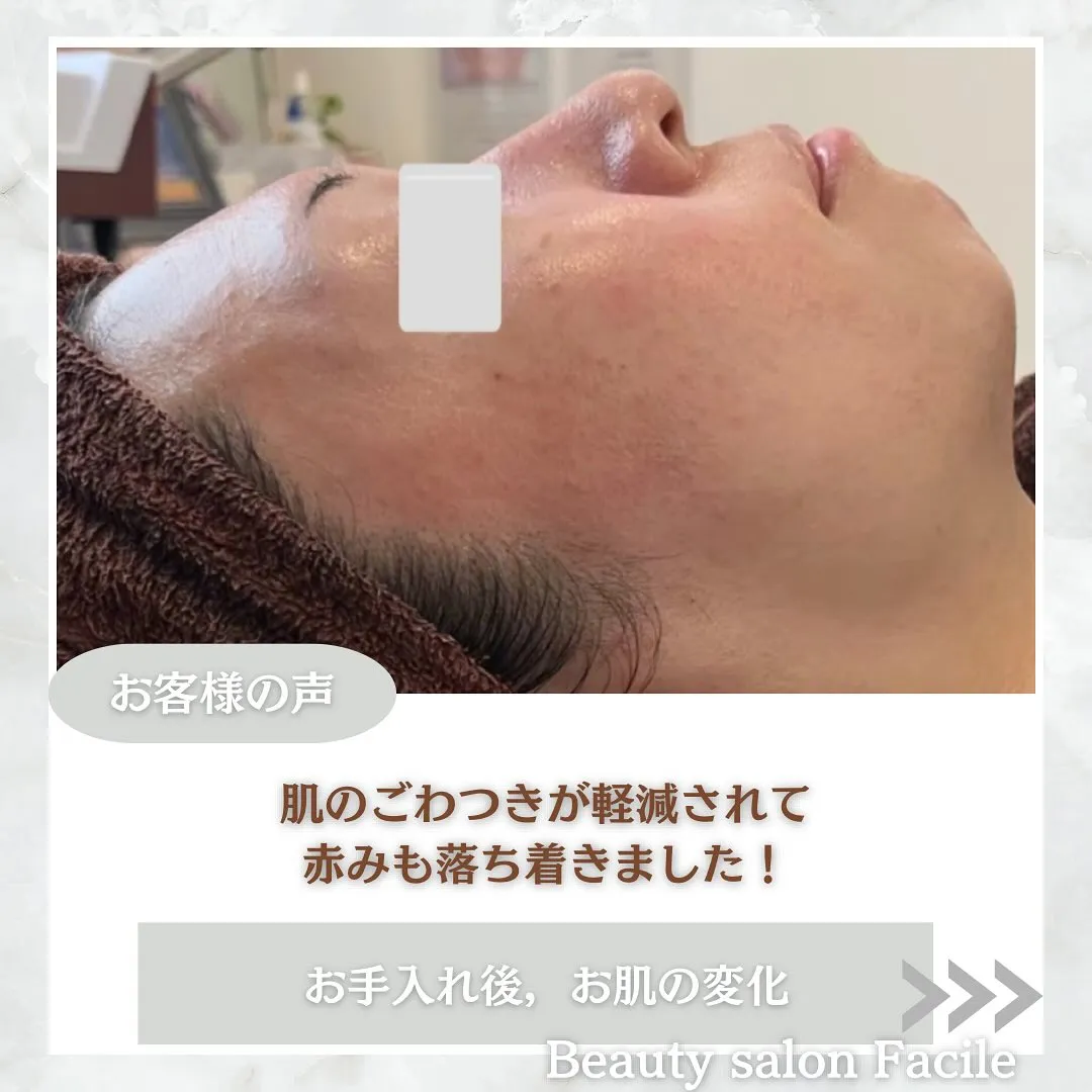 太田市にある頑固なニキビ専門店です✨️