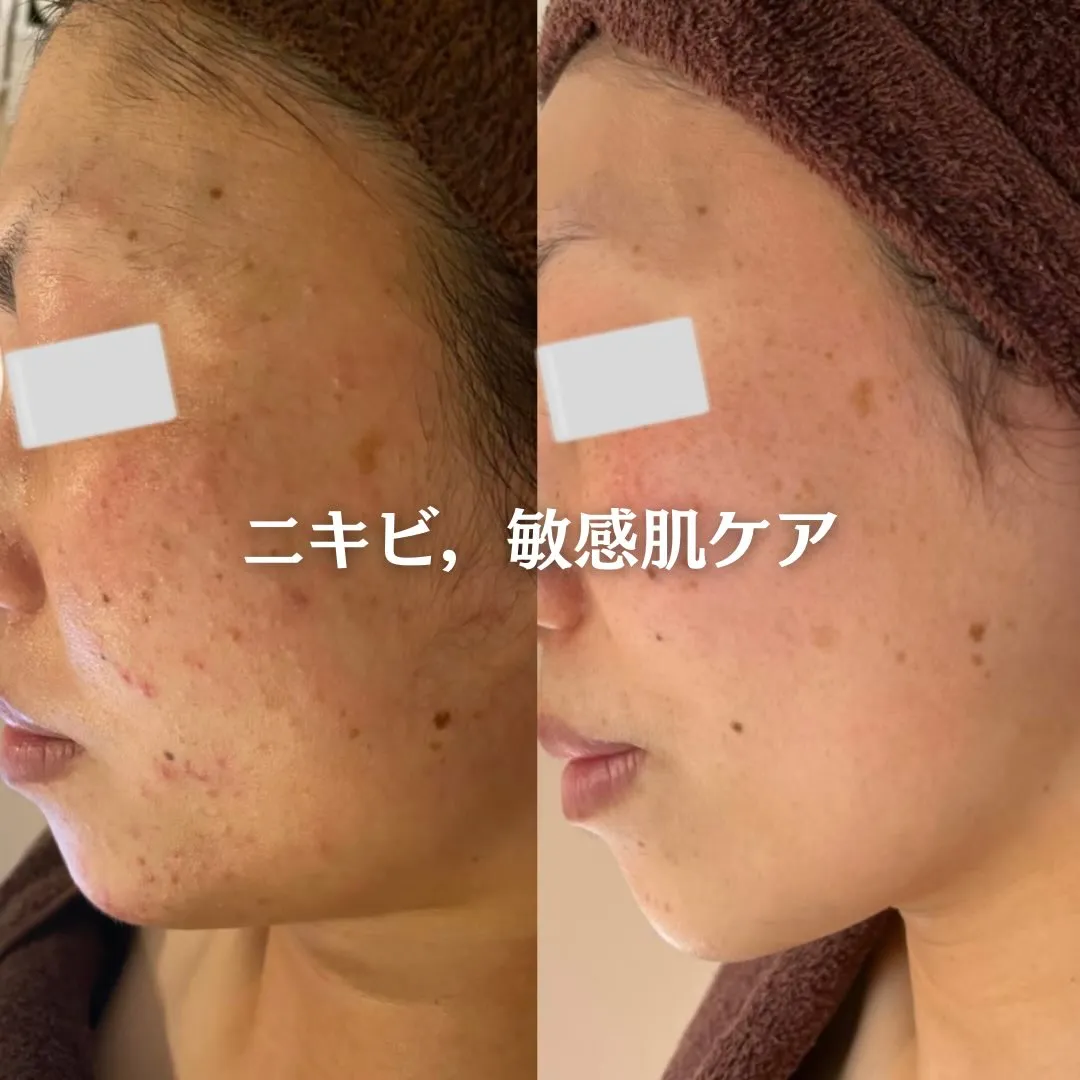 @beautysalonfacile 👈🏻他投稿もチェック