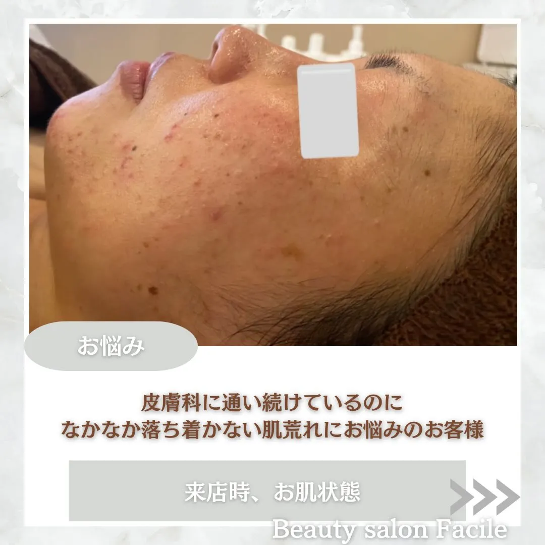 @beautysalonfacile 👈🏻他投稿もチェック