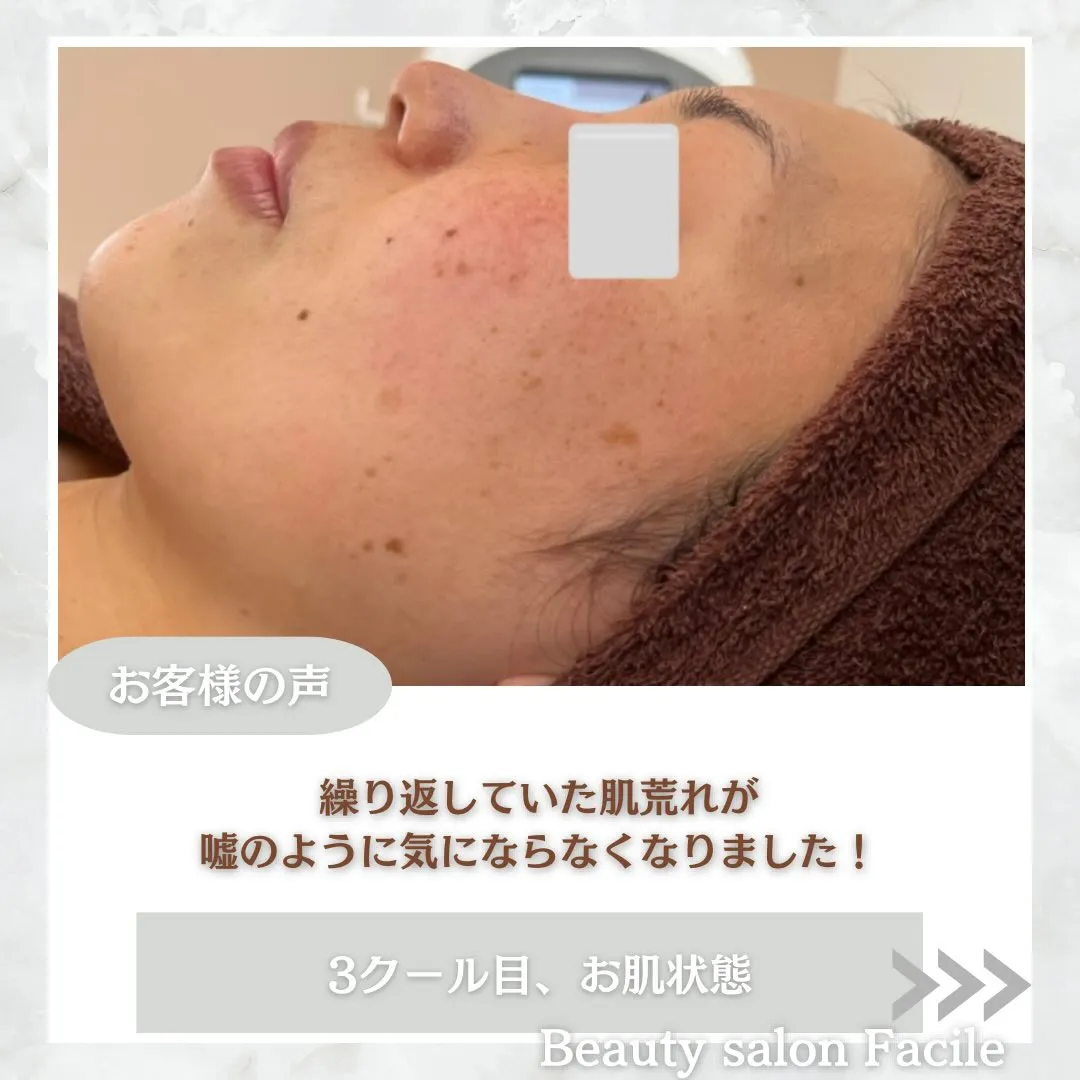 @beautysalonfacile 👈🏻他投稿もチェック