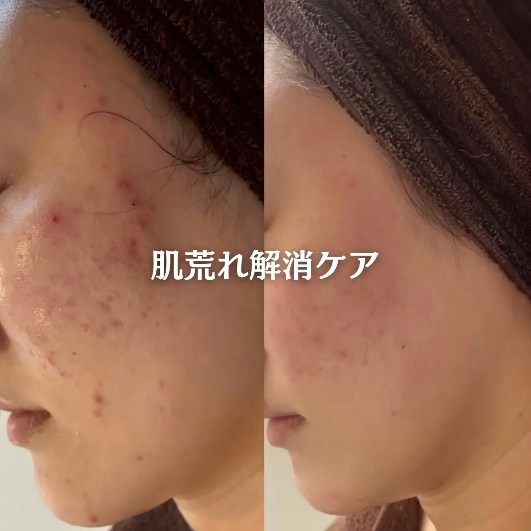 @beautysalonfacile 👈🏻他投稿もチェック