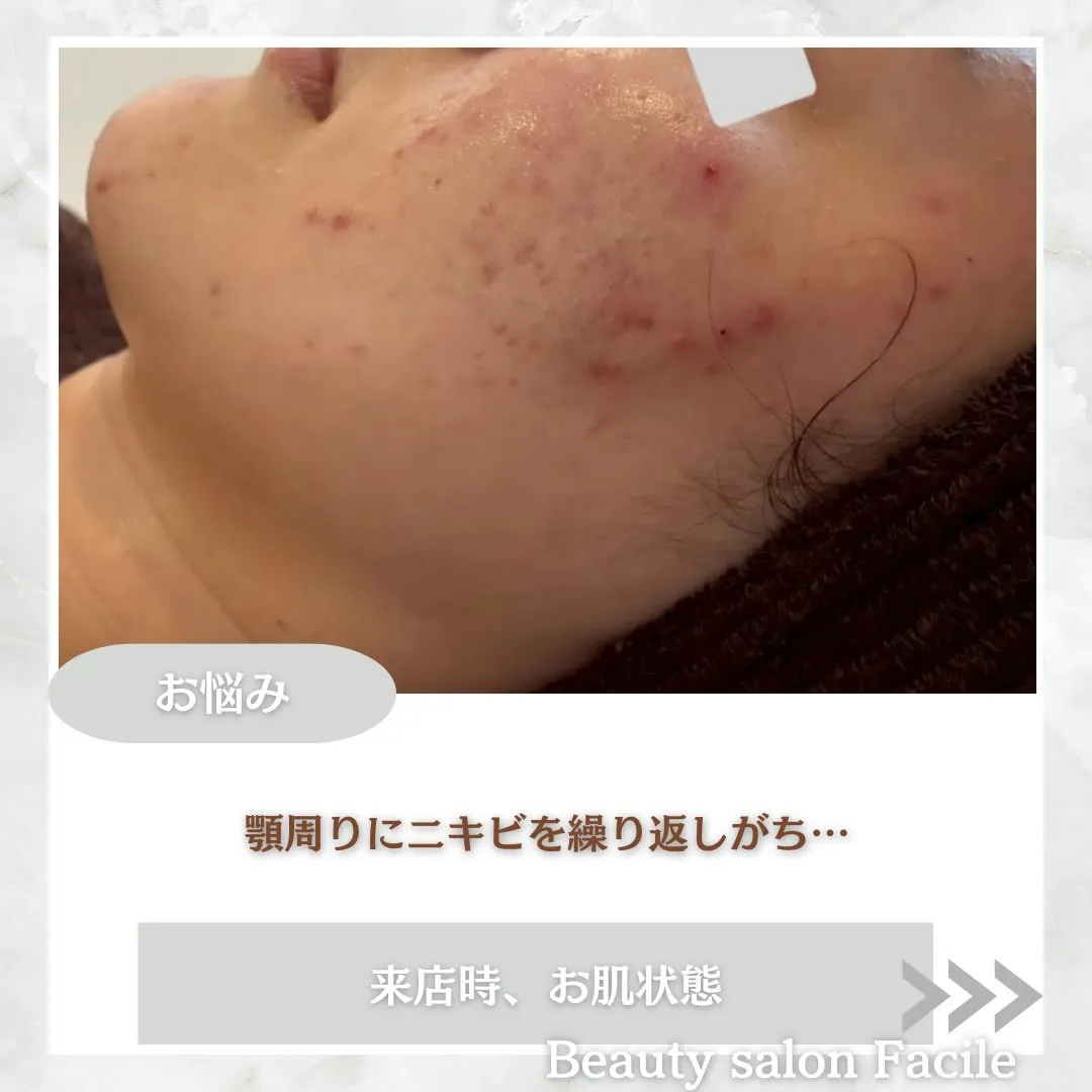@beautysalonfacile 👈🏻他投稿もチェック