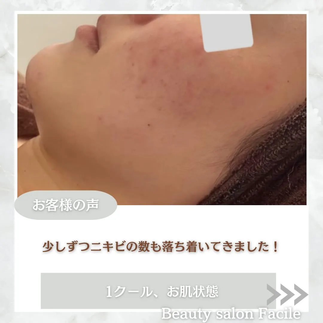 @beautysalonfacile 👈🏻他投稿もチェック