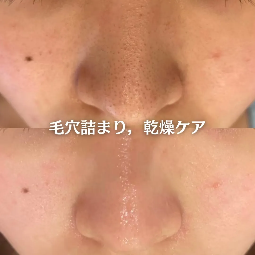 @beautysalonfacile 👈🏻他投稿もチェック