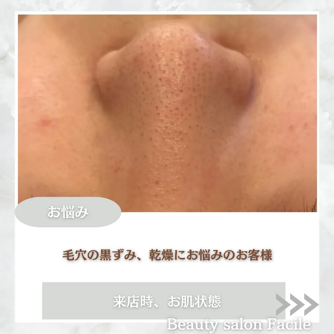 @beautysalonfacile 👈🏻他投稿もチェック