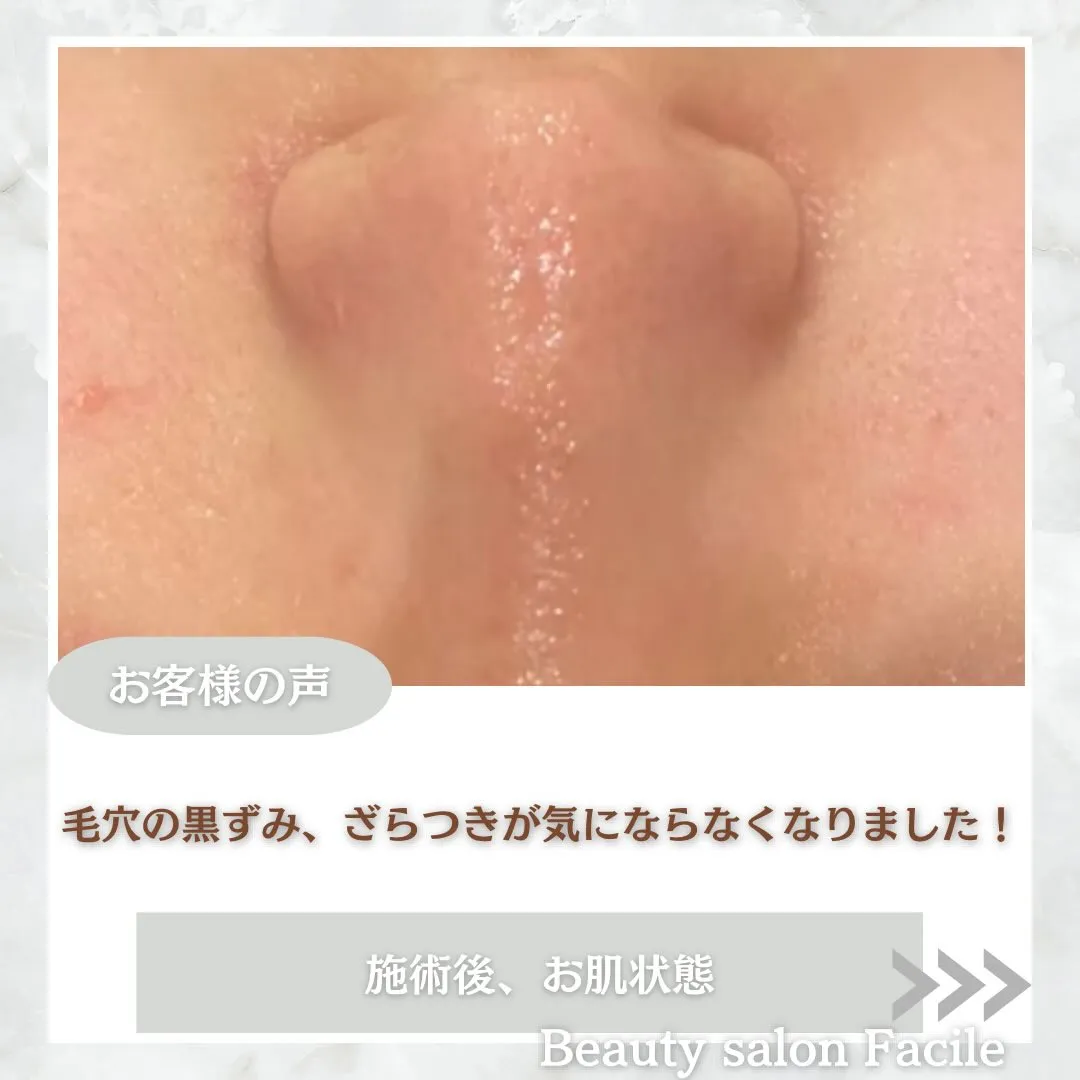 @beautysalonfacile 👈🏻他投稿もチェック