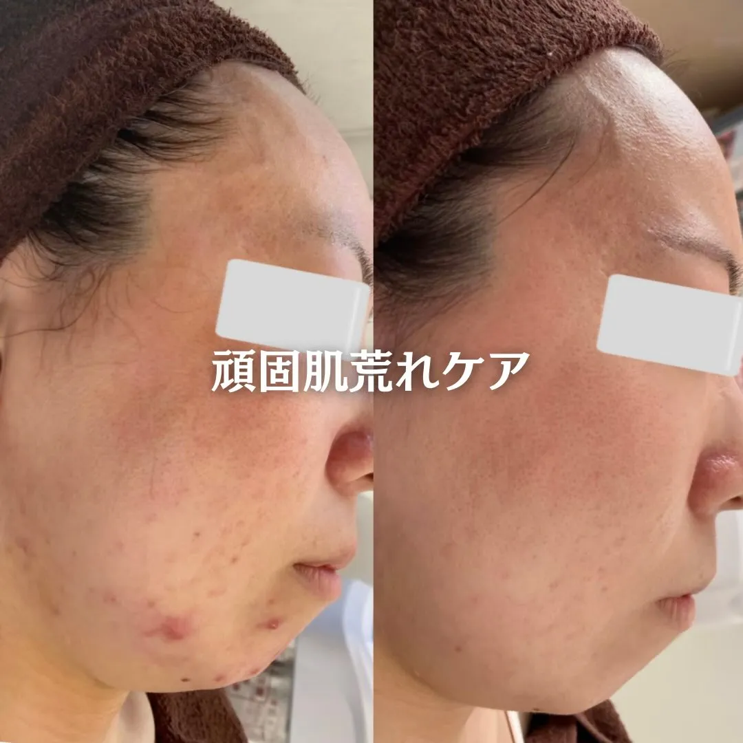 @beautysalonfacile 👈🏻他投稿もチェック