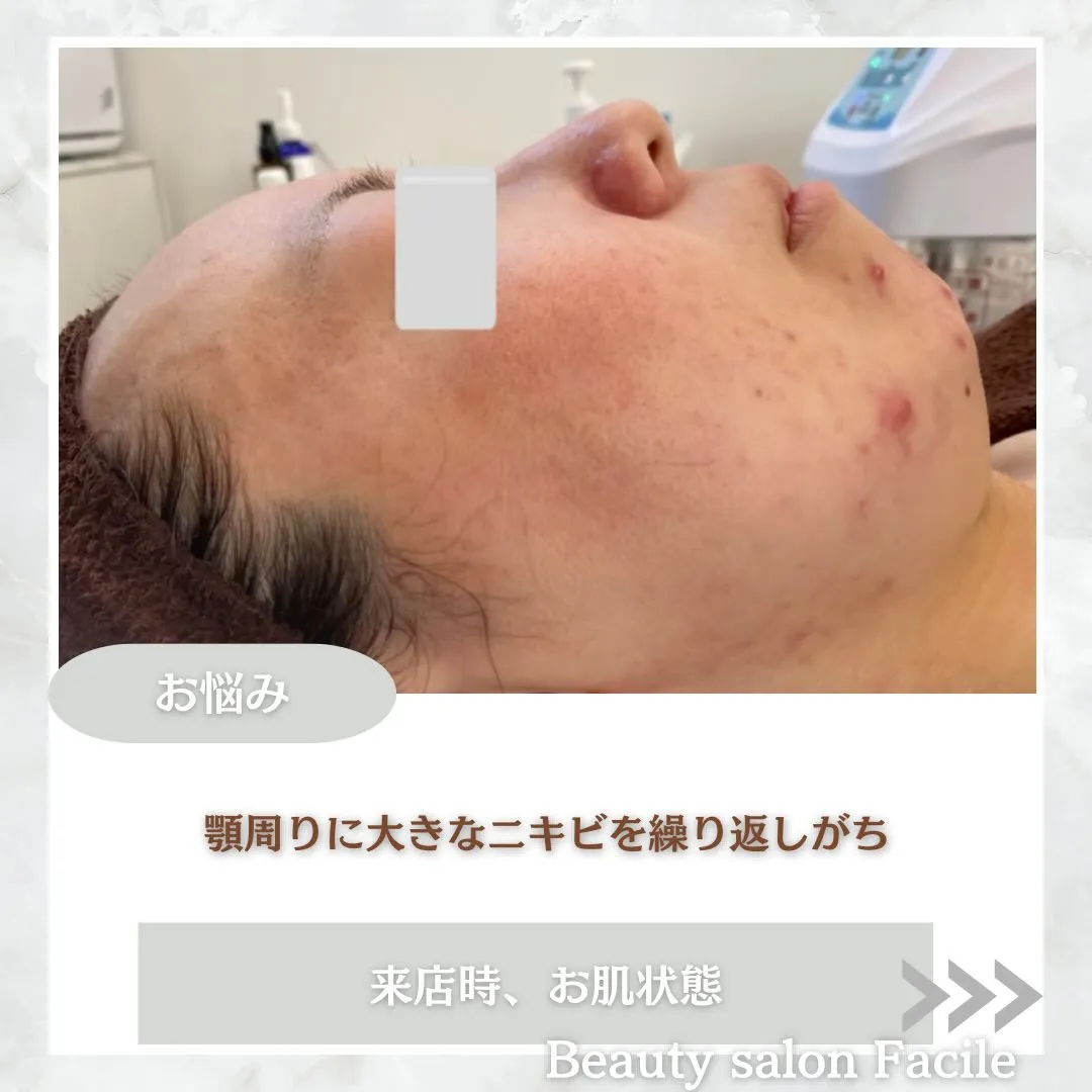 @beautysalonfacile 👈🏻他投稿もチェック