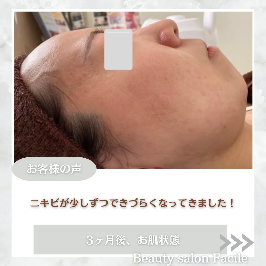 @beautysalonfacile 👈🏻他投稿もチェック