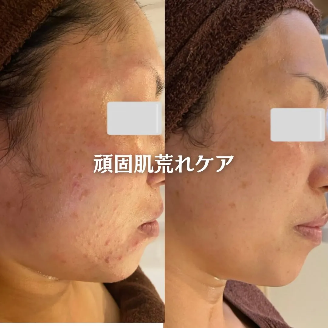 @beautysalonfacile 👈🏻他投稿もチェック