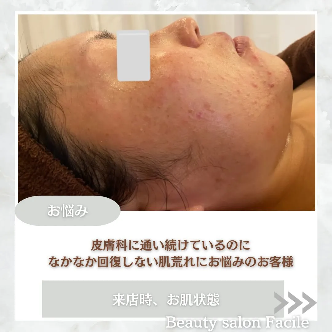 @beautysalonfacile 👈🏻他投稿もチェック