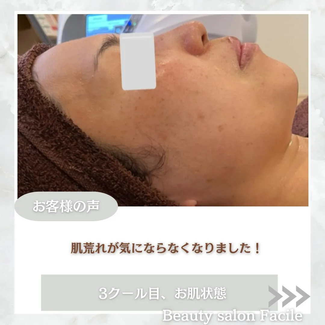 @beautysalonfacile 👈🏻他投稿もチェック
