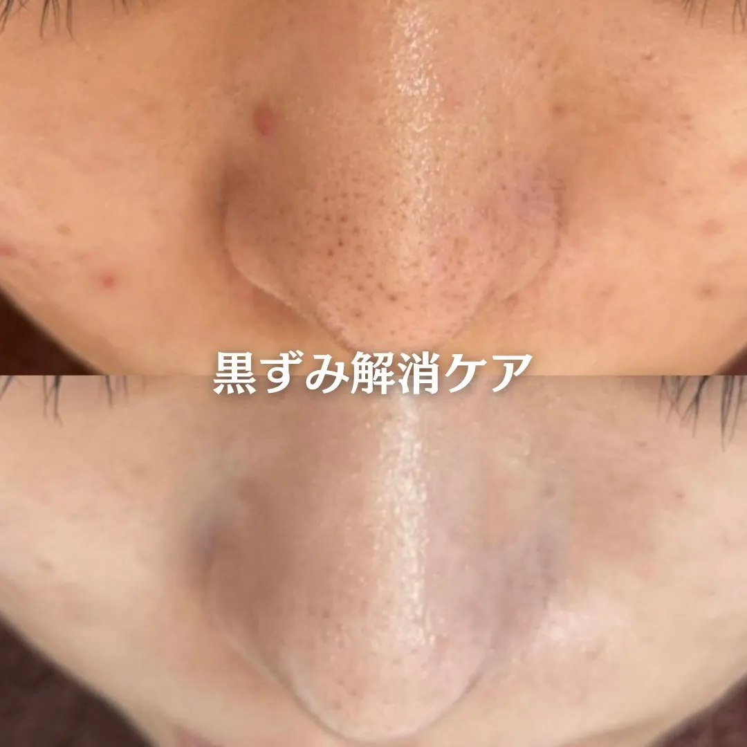 @beautysalonfacile 👈🏻他投稿もチェック