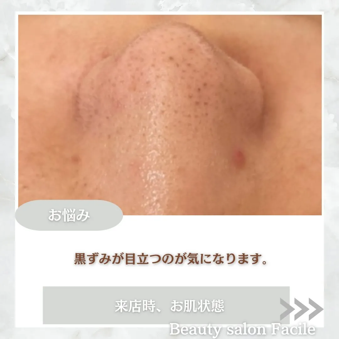 @beautysalonfacile 👈🏻他投稿もチェック