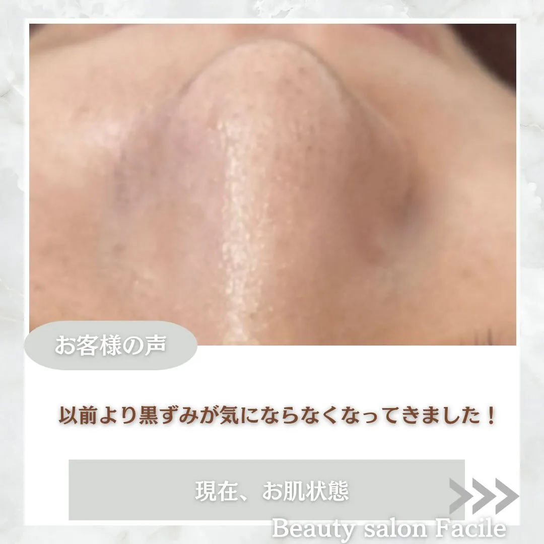 @beautysalonfacile 👈🏻他投稿もチェック
