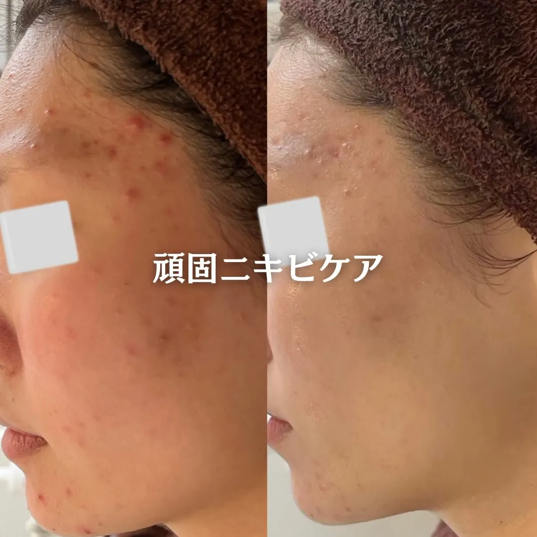 @beautysalonfacile 👈🏻他投稿もチェック