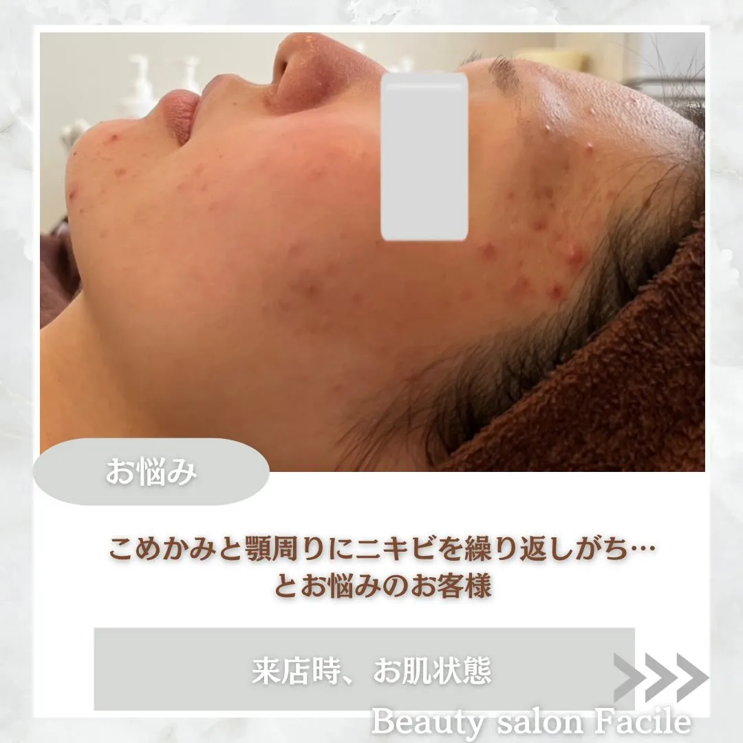 @beautysalonfacile 👈🏻他投稿もチェック