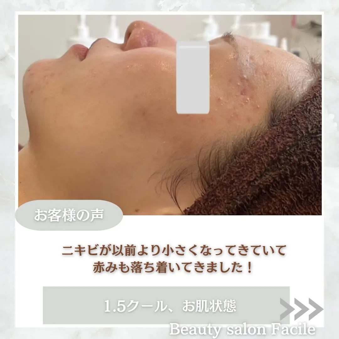 @beautysalonfacile 👈🏻他投稿もチェック