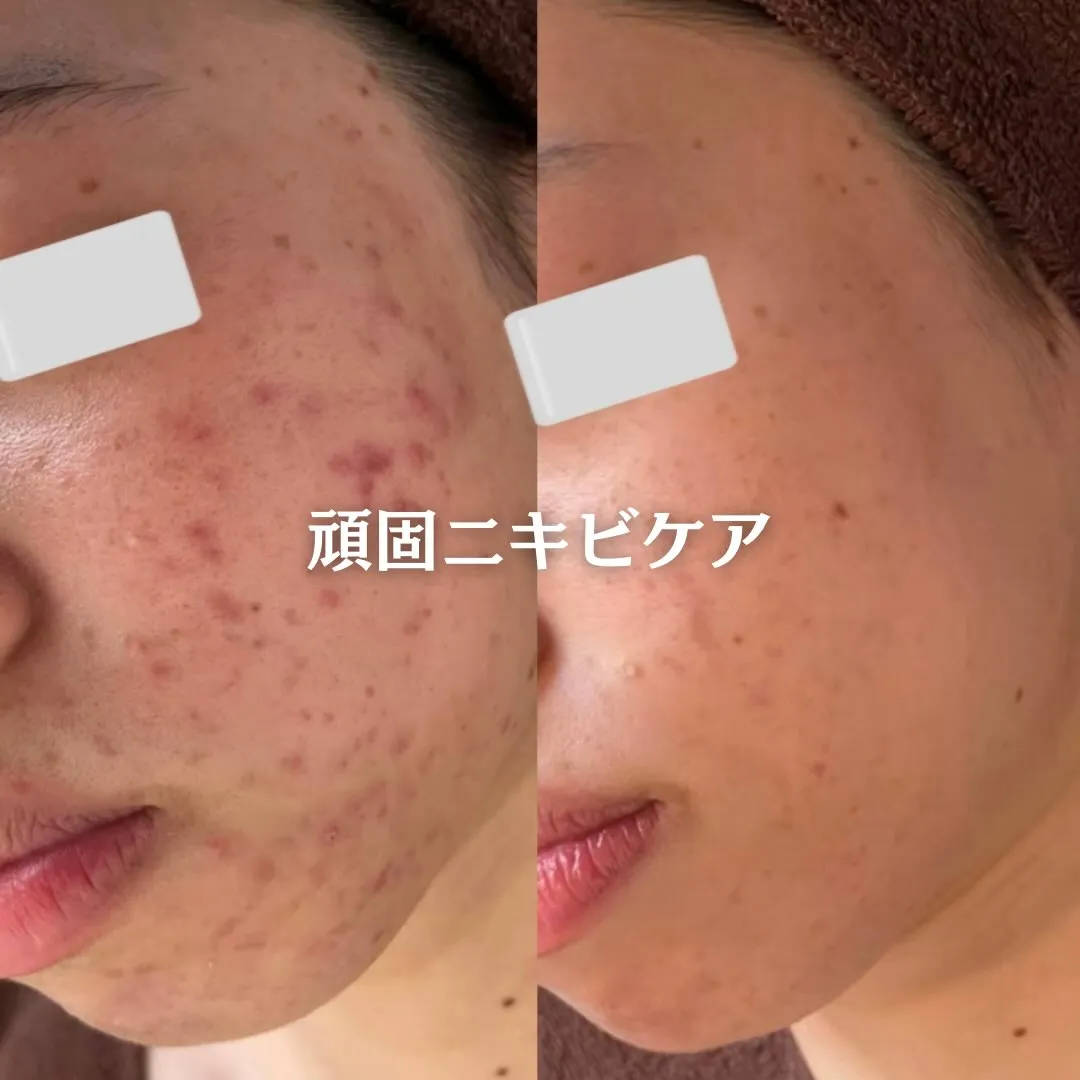 @beautysalonfacile 👈🏻他投稿もチェック