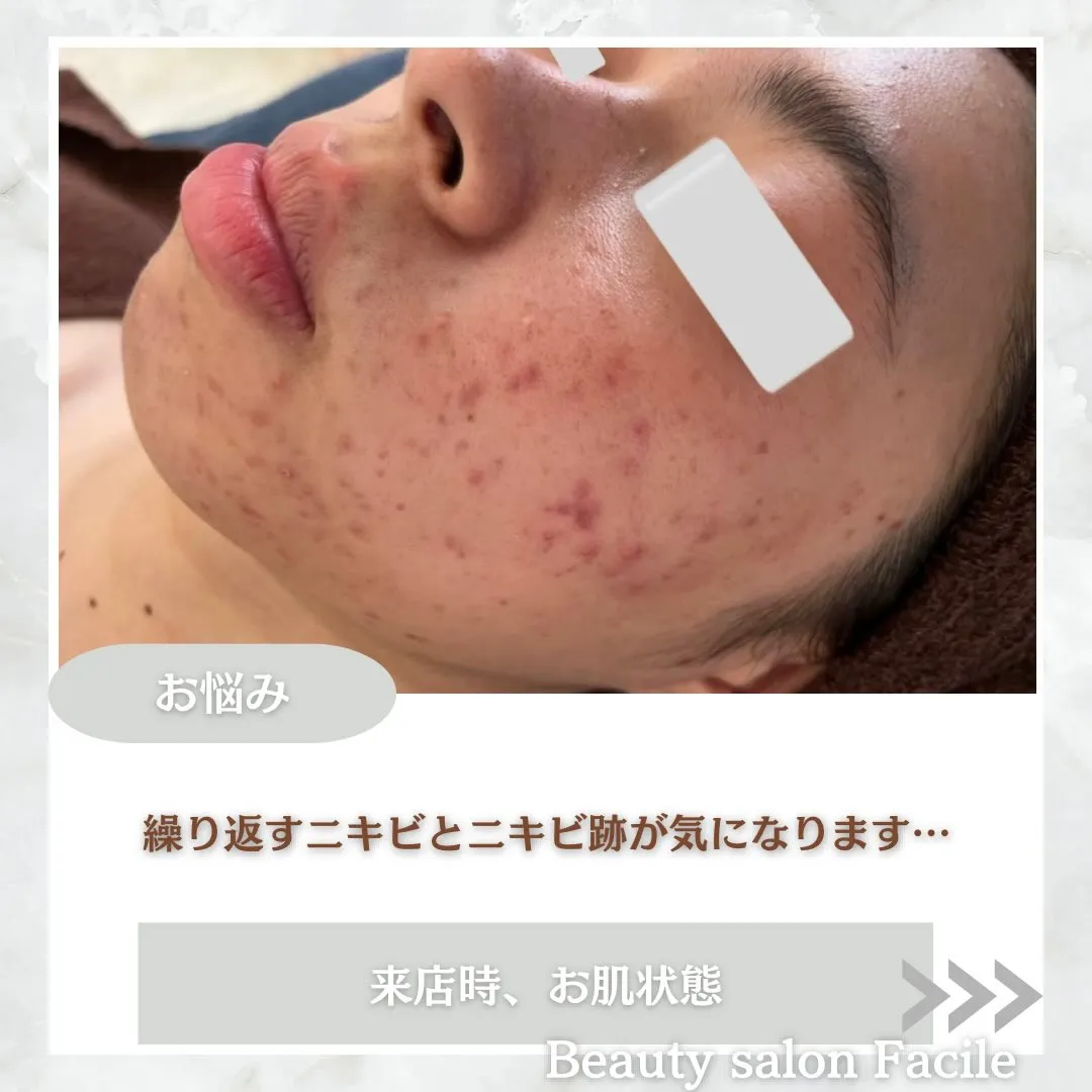 @beautysalonfacile 👈🏻他投稿もチェック