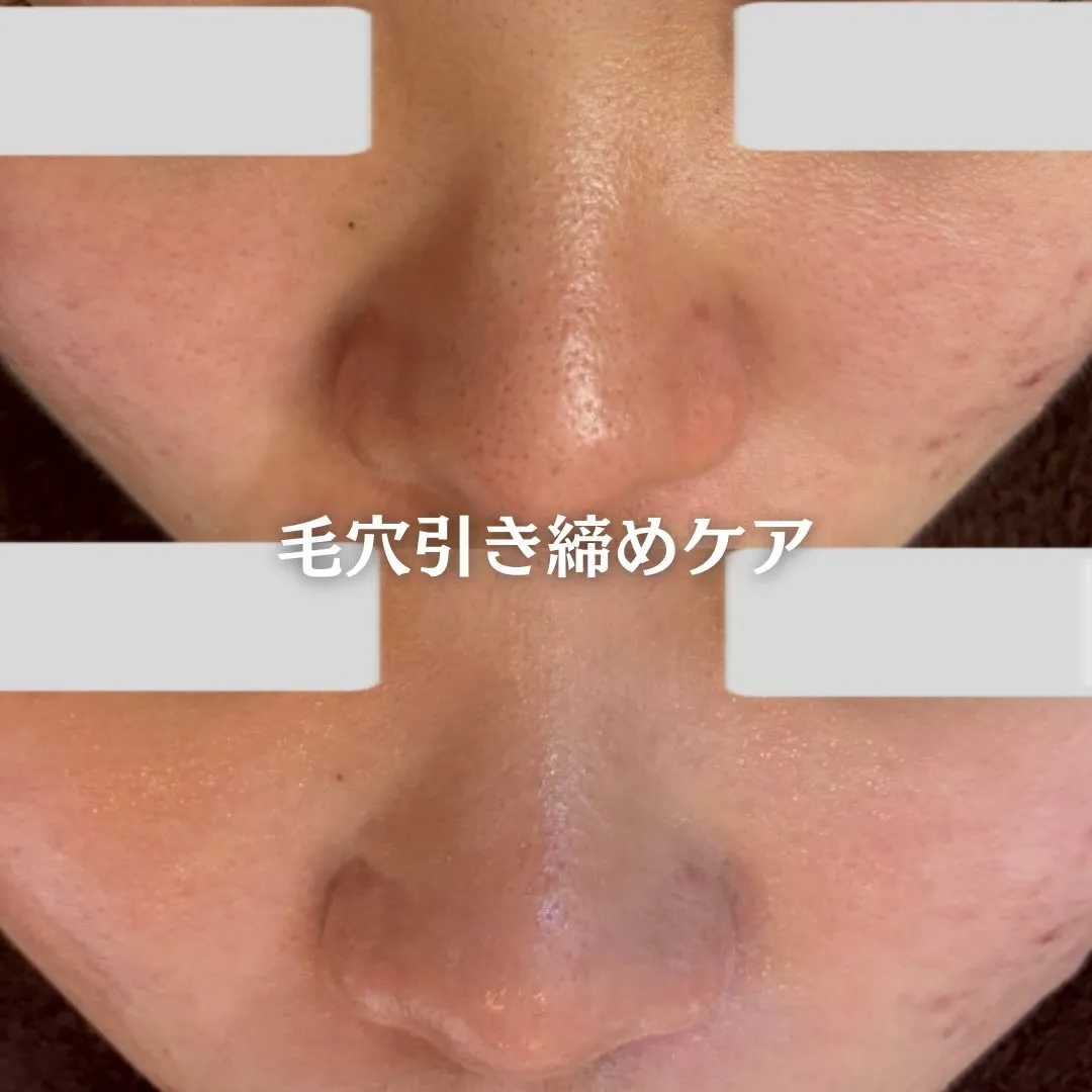 @beautysalonfacile 👈🏻他投稿もチェック