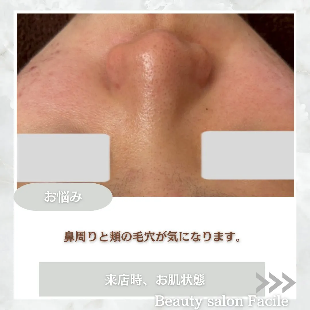 @beautysalonfacile 👈🏻他投稿もチェック