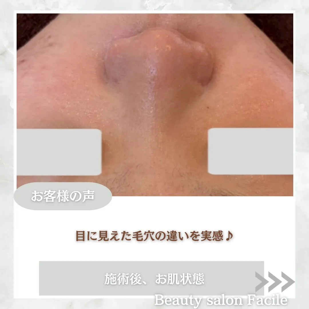 @beautysalonfacile 👈🏻他投稿もチェック