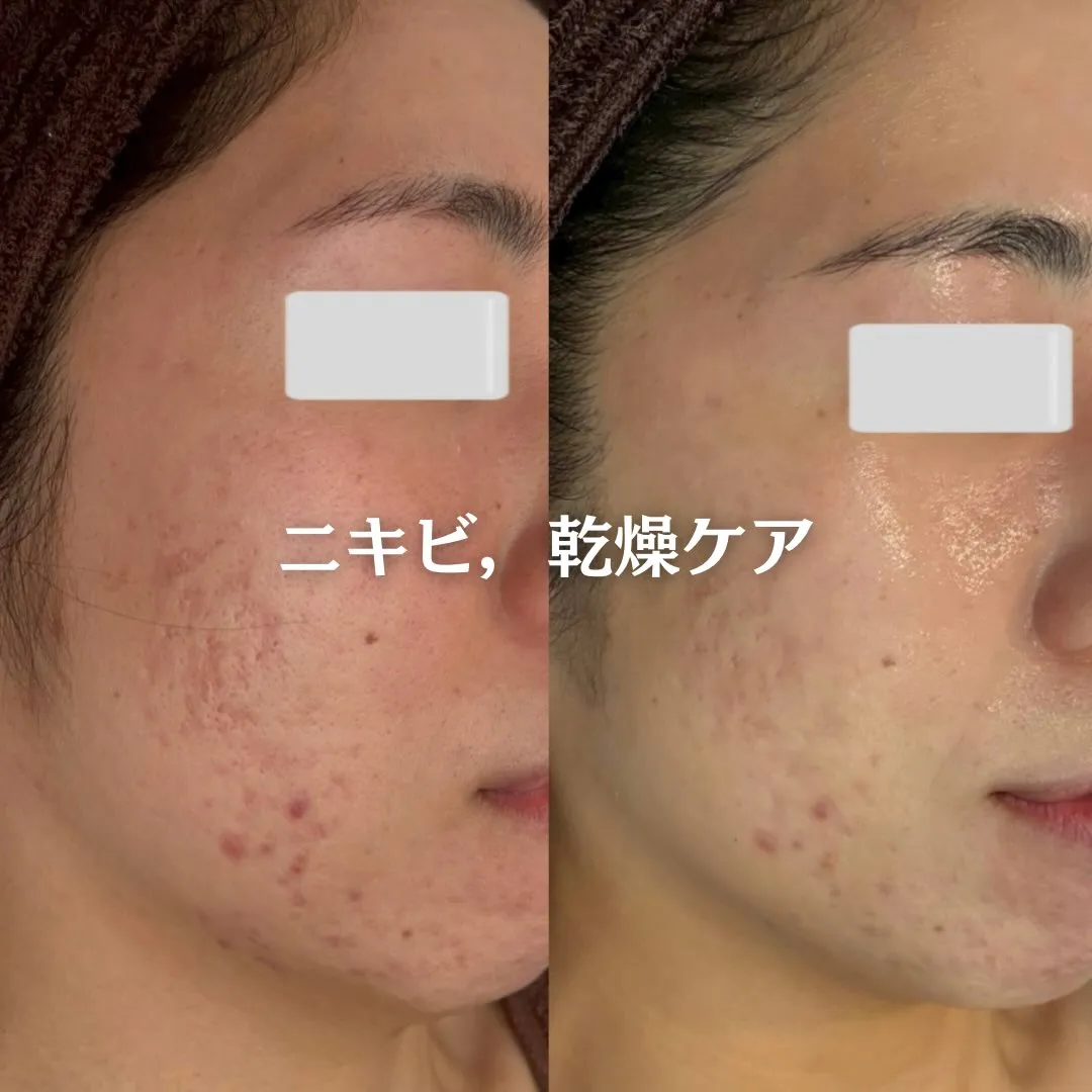 @beautysalonfacile 👈🏻他投稿もチェック