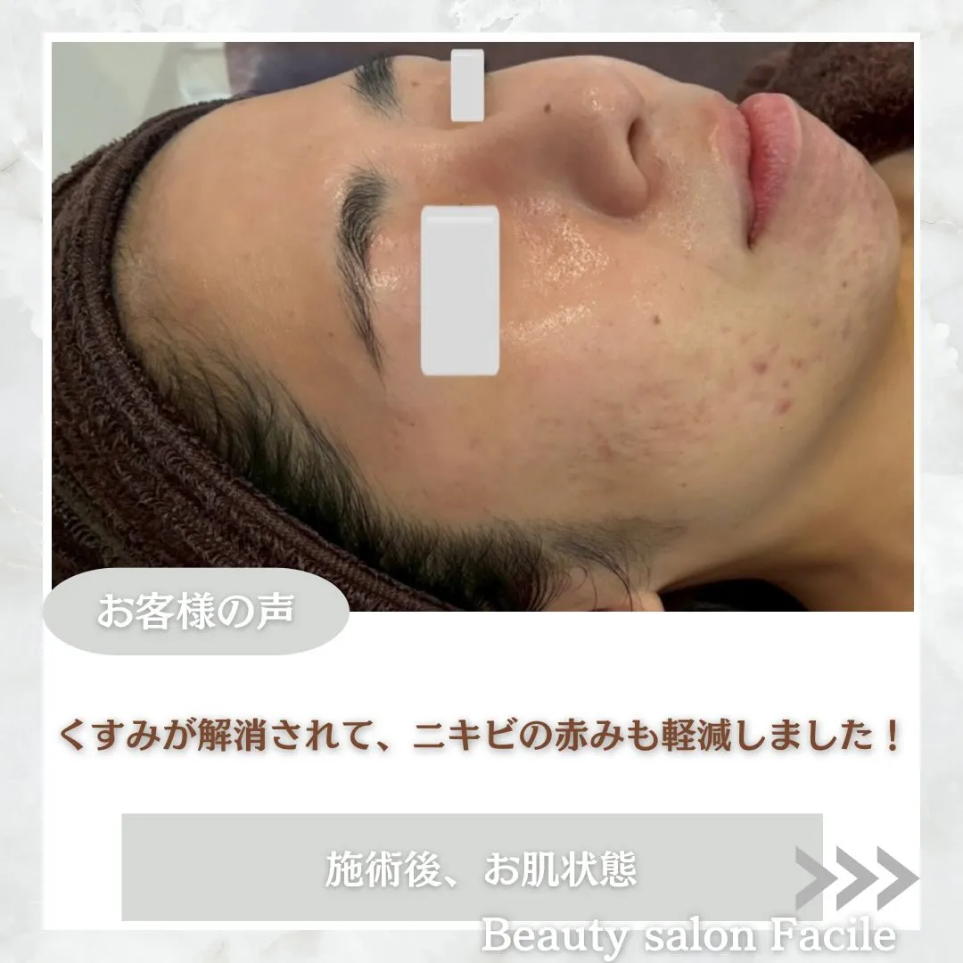 @beautysalonfacile 👈🏻他投稿もチェック