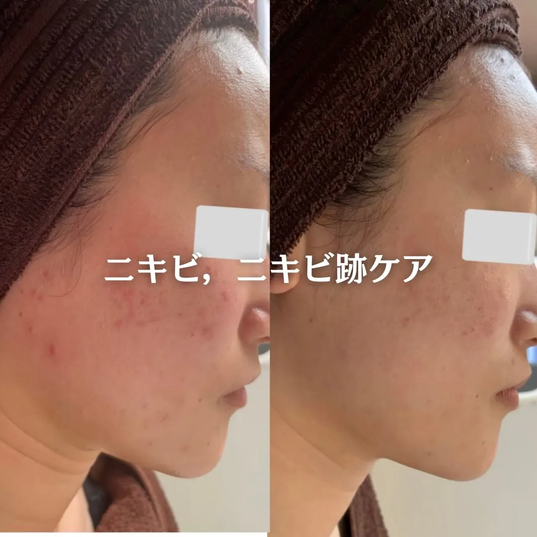 @beautysalonfacile 👈🏻他投稿もチェック