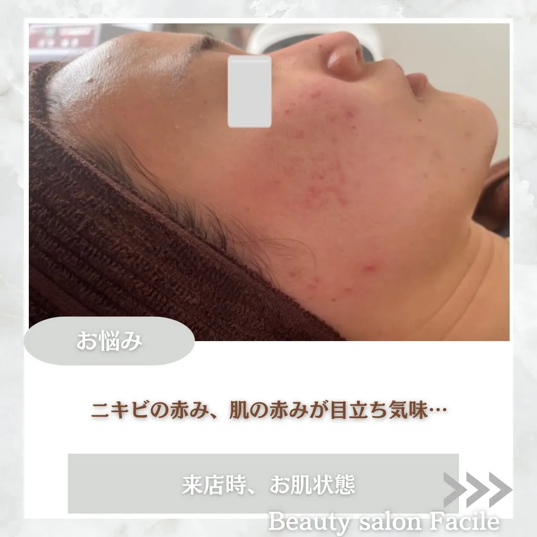 @beautysalonfacile 👈🏻他投稿もチェック