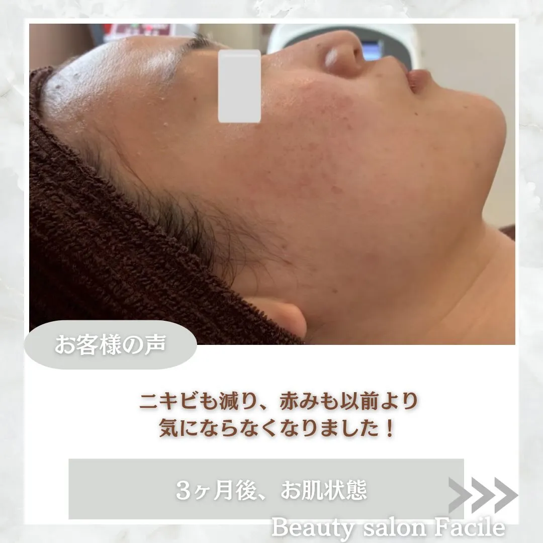 @beautysalonfacile 👈🏻他投稿もチェック