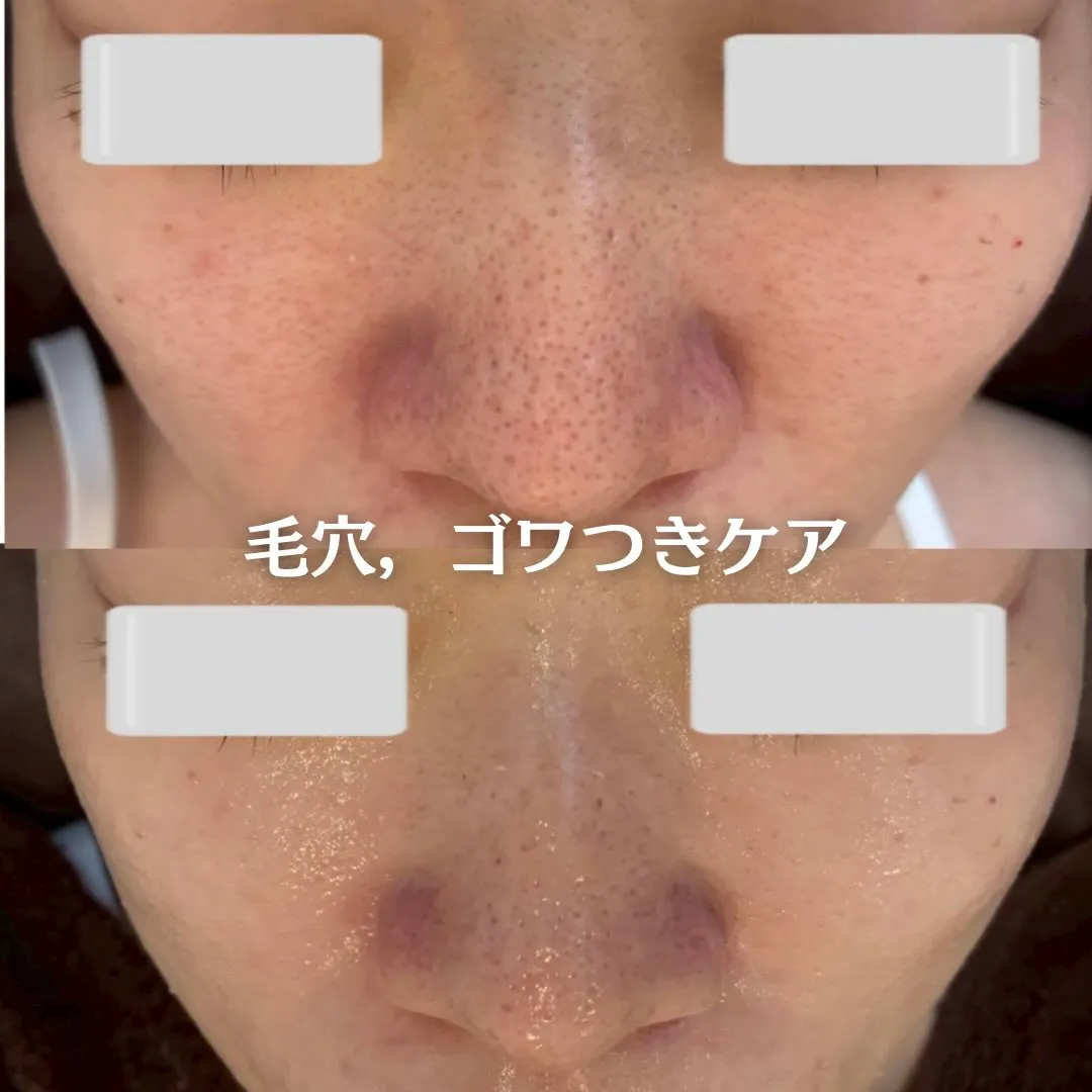 @beautysalonfacile 👈🏻他投稿もチェック