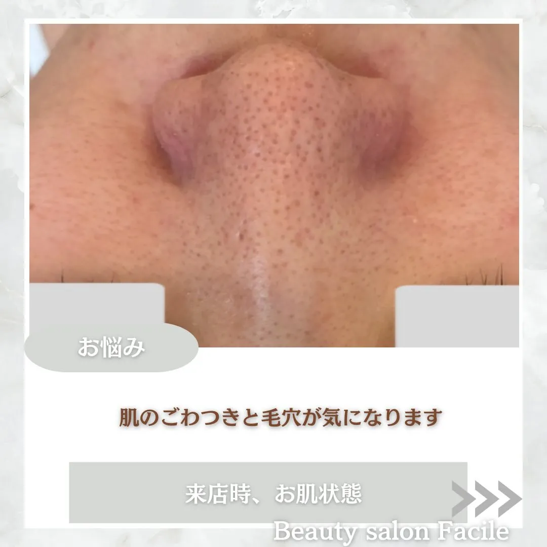 @beautysalonfacile 👈🏻他投稿もチェック