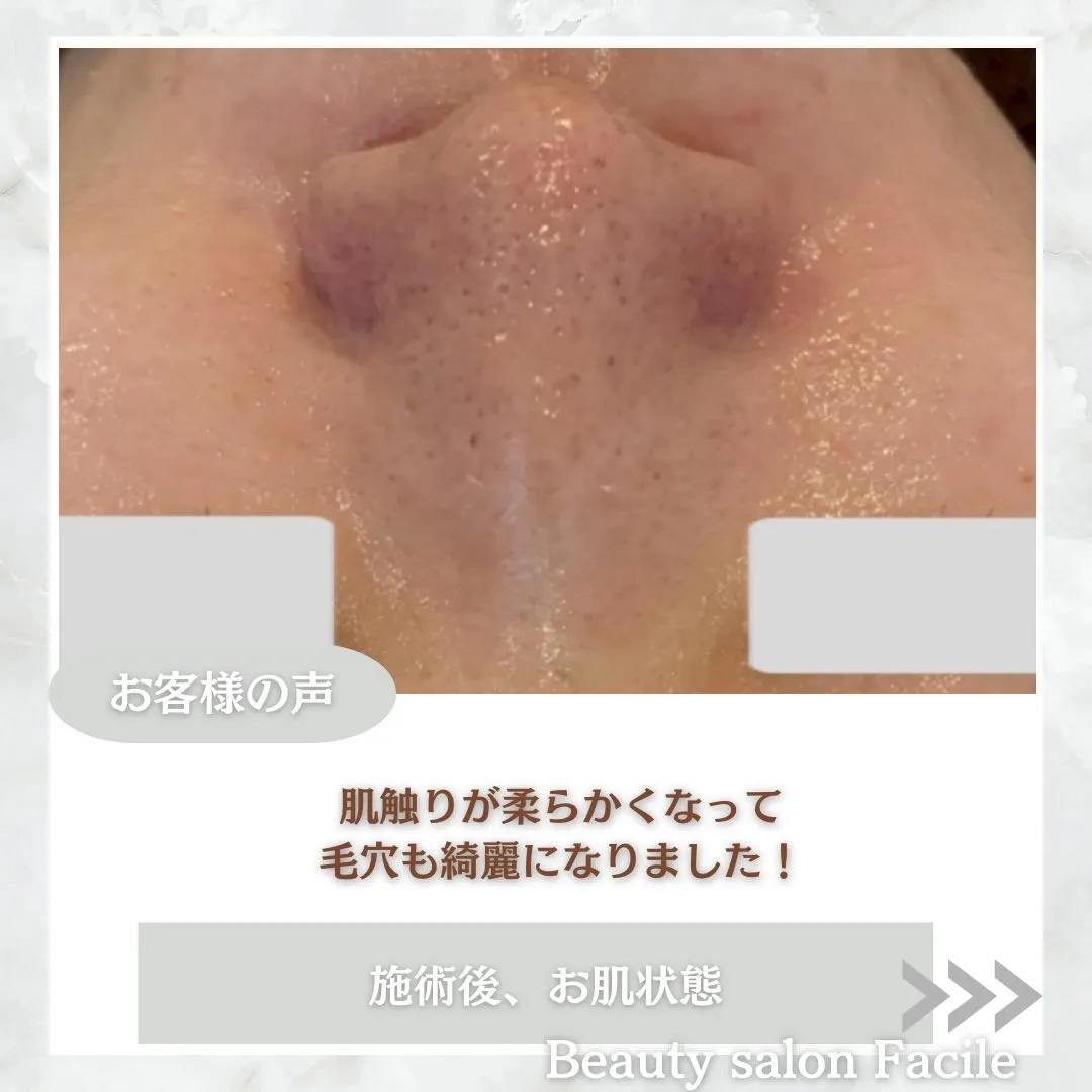@beautysalonfacile 👈🏻他投稿もチェック