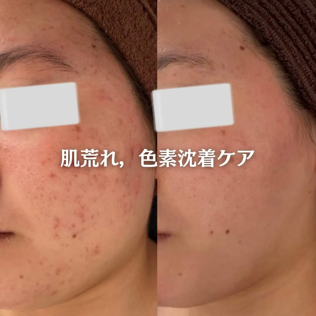 @beautysalonfacile 👈🏻他投稿もチェック