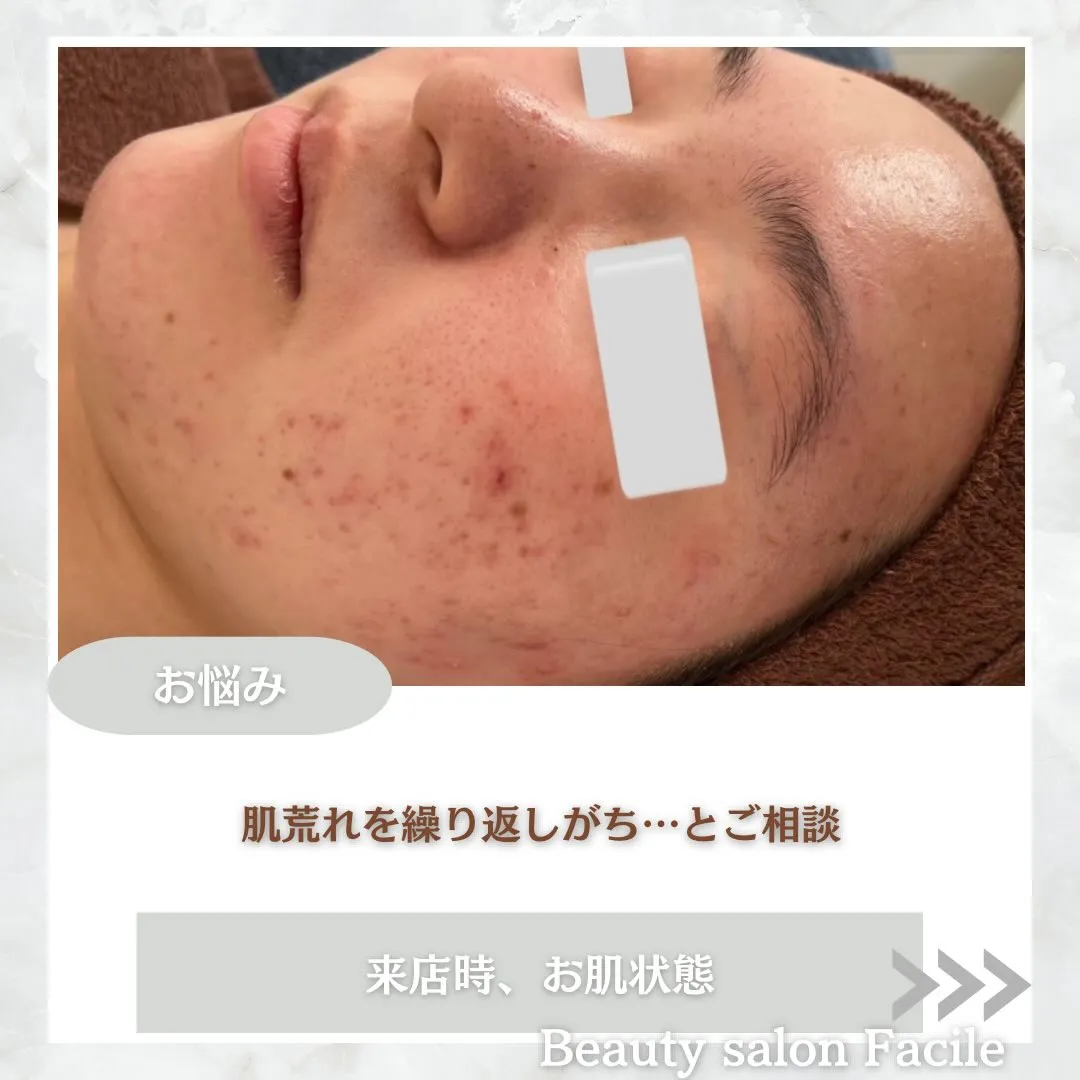 @beautysalonfacile 👈🏻他投稿もチェック