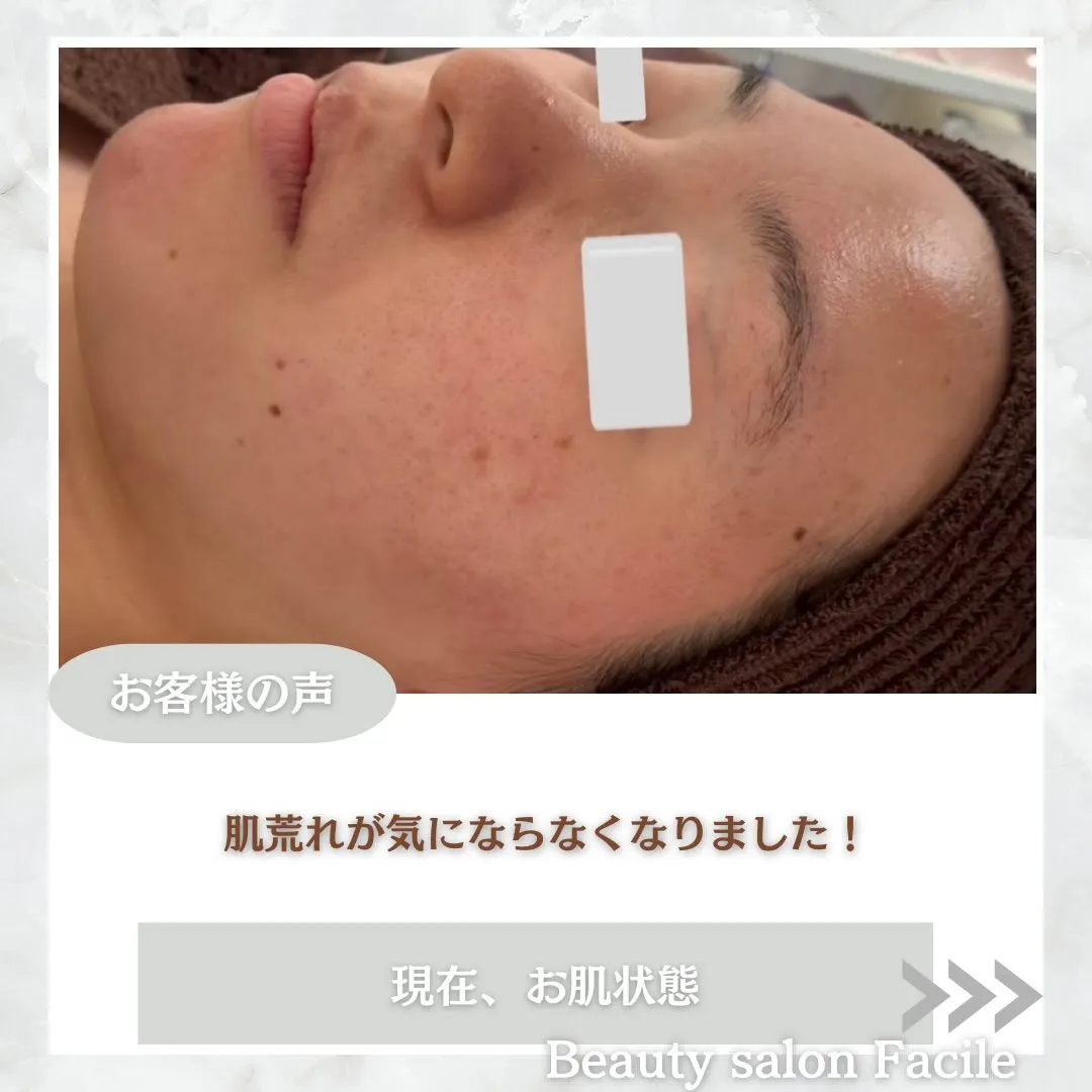 @beautysalonfacile 👈🏻他投稿もチェック