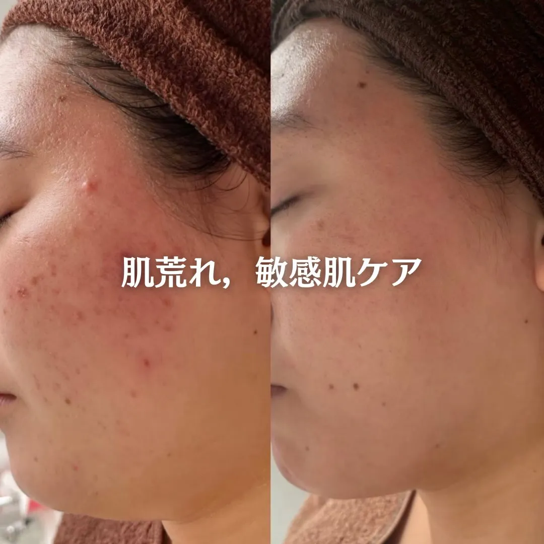 @beautysalonfacile 👈🏻他投稿もチェック