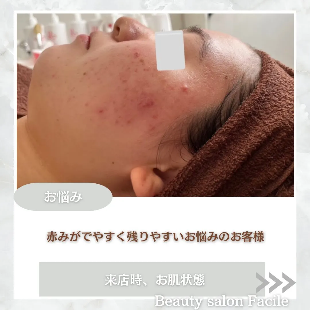 @beautysalonfacile 👈🏻他投稿もチェック
