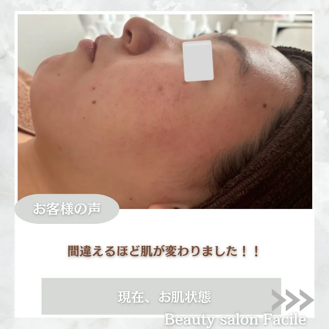 @beautysalonfacile 👈🏻他投稿もチェック
